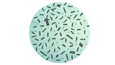 Toxina Botulínica (LD50 < 2ng/kg)